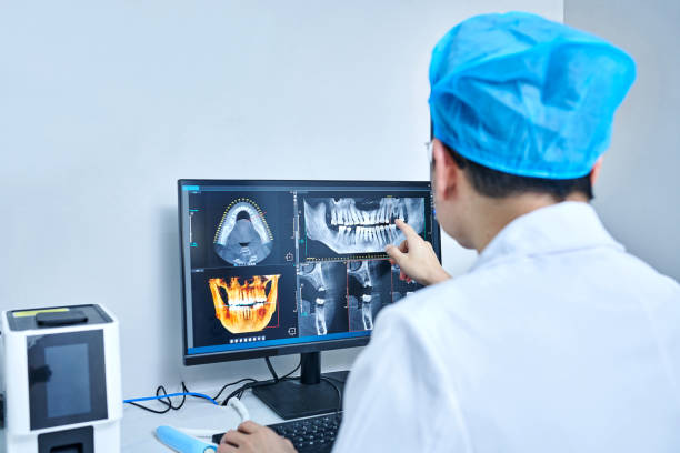 Best Emergency Root Canal Treatment in Butler, MO