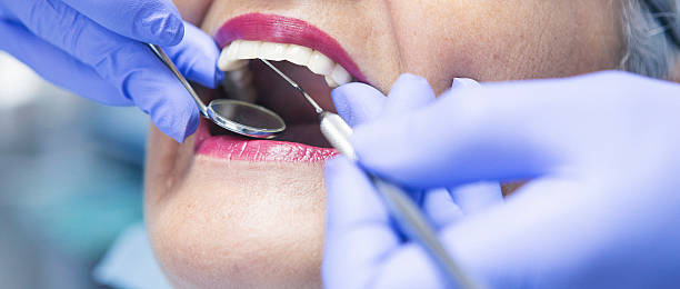 Best Emergency Treatment for Dental Infections or Abscesses in Butler, MO